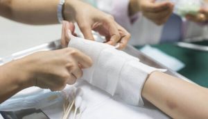 Hướng dẫn chăm sóc vết thương sau khi cắt chỉ