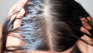tại sao tóc nhanh bết?